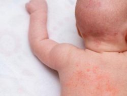 6 rekomendasi sabun biang keringat aman untuk kulit sensitif bayi